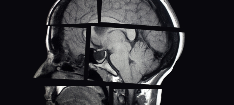 segmented x-ray of human skull