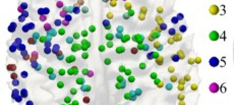 human brain with colored plot points.