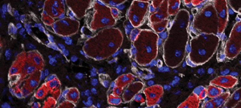 cell microscopy image, blue and red